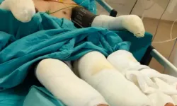 Seyitgazi yangınında ağır yaralanan kahraman ormancı Kader Dereli'nin son halini eşi paylaştı