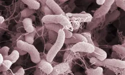 Et yiyen bakteri paniği! Sağlık Bakanlığı’ndan ‘Vibrio’ açıklaması